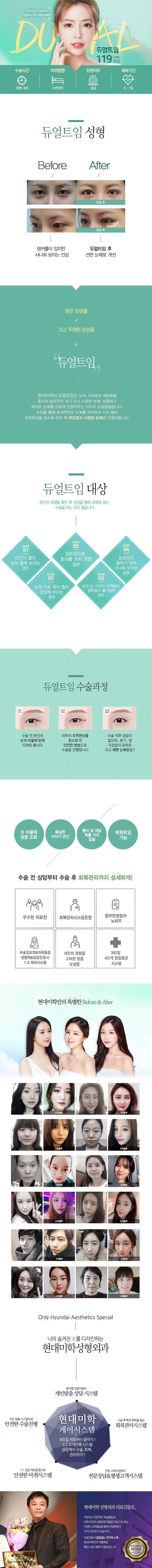 서울 신사동 현대미학성형외과의 119만원 듀얼트임 눈매확장술로 눈의 가로폭과 세로폭을 늘려 시원하고 자연스러운 눈매 완성