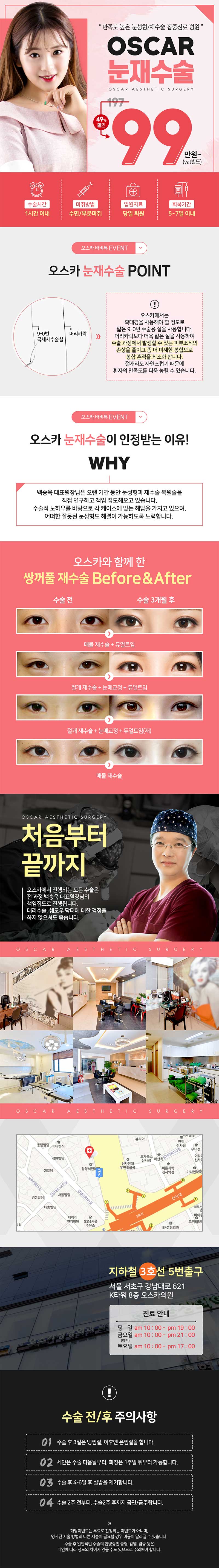 서울 신사동 오스카성형외과의 눈재수술 집중진료 99만원 특별 이벤트