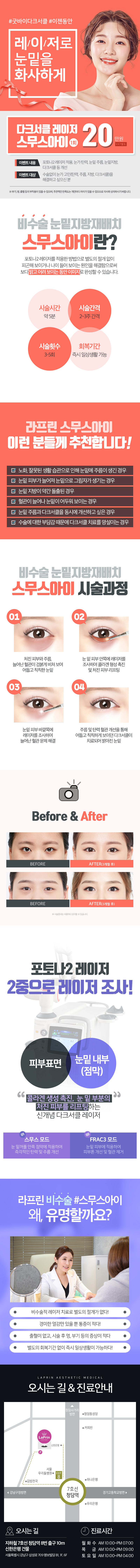 20만원으로 받는 비수술 다크서클 레이저 시술로 눈밑 지방 재배치와 주름 개선을 한번에 해결하는 라프린의원의 스무스아이 프로그램
