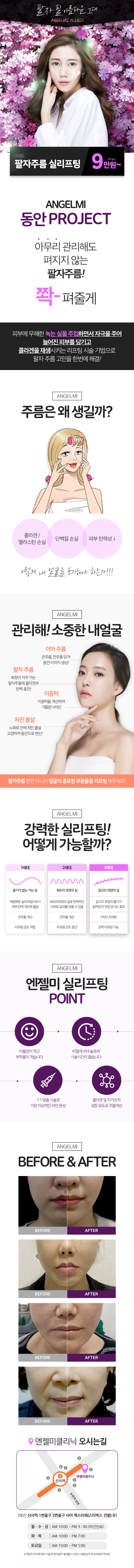 서울 신사동 엔젤미클리닉의 팔자주름 개선을 위한 실리프팅 시술 9만원 특가 프로모션
