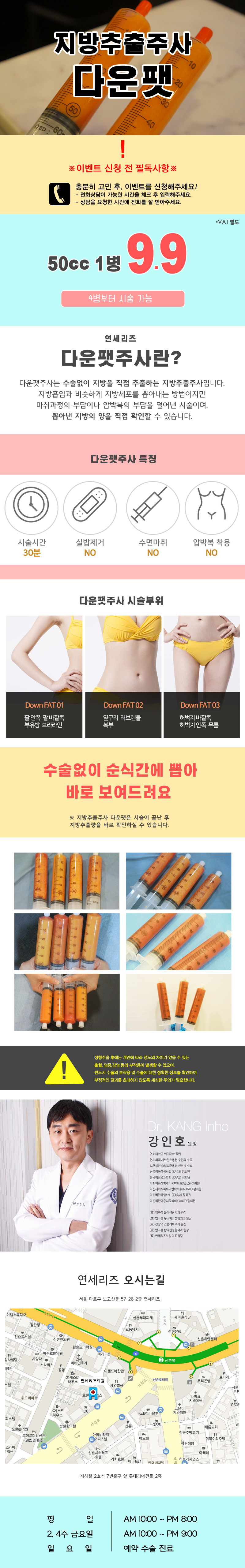 연세리즈의 지방추출주사 다운팻: 수술 없이 빠른 시간 내 지방 분해가 가능한 9.9만원 시술