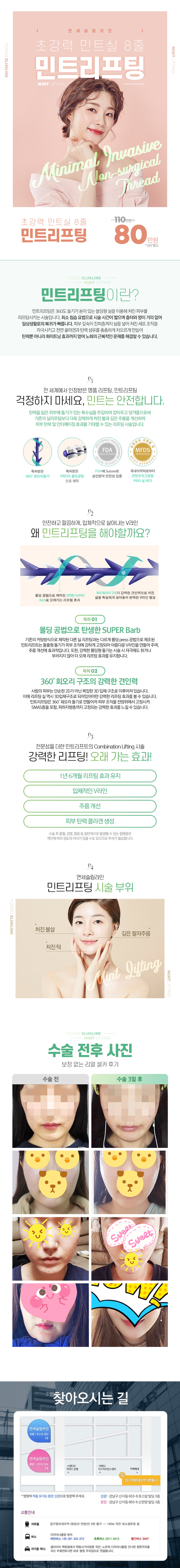 연세슬림라인의 민트리프팅 - 8줄 초강력 민트실을 활용한 처진 볼살과 깊은 주름 개선 프리미엄 시술