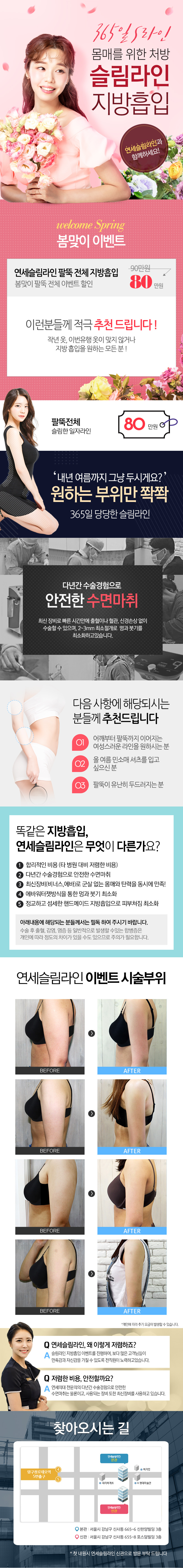 연세슬림라인의 360도 팔뚝 지방흡입 시술로 앞볼록, 뒷볼록한 팔뚝을 80만원 특가로 가녀린 팔로 개선