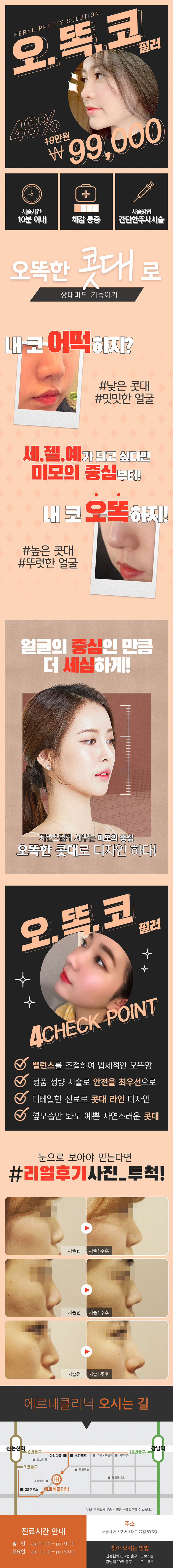 강남 에르네클리닉의 9.9만원 오똑코 성형 시술로 자연스러운 콧대 라인 완성