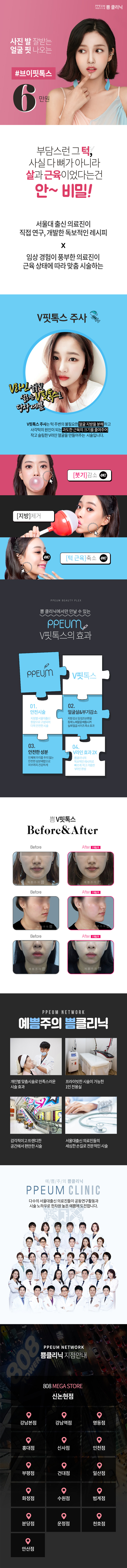 서울 교대 쁨클리닉의 V라인 완성을 위한 V핏톡스 시술 (6만원) - 사진발이 잘 받는 얼굴형 만들기 프로그램