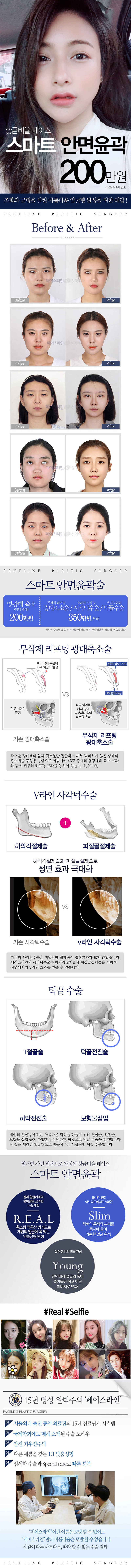 서울 압구정 페이스라인성형외과의원의 200만원 스마트 안면윤곽 수술로 자연스러운 V라인 형성