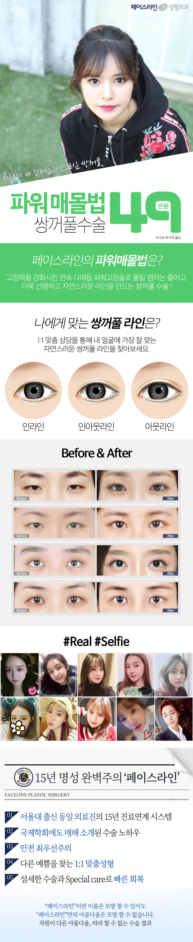 서울 압구정 페이스라인성형외과의 49만원 파워매몰법 쌍꺼풀수술로 풀리지 않는 자연스러운 쌍꺼풀 형성