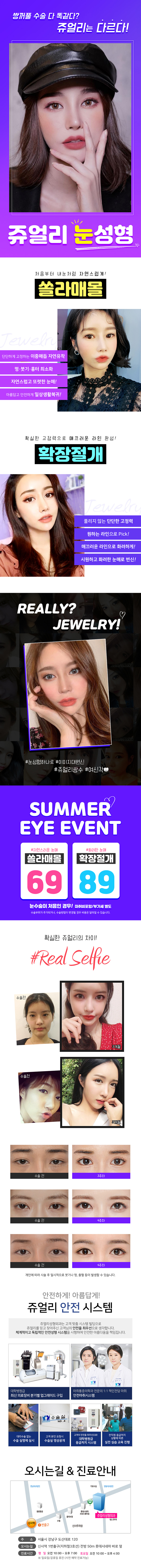 서울 신사동 쥬얼리성형외과의 자연스러운 쌍꺼풀 수술 69만원 특가 이벤트