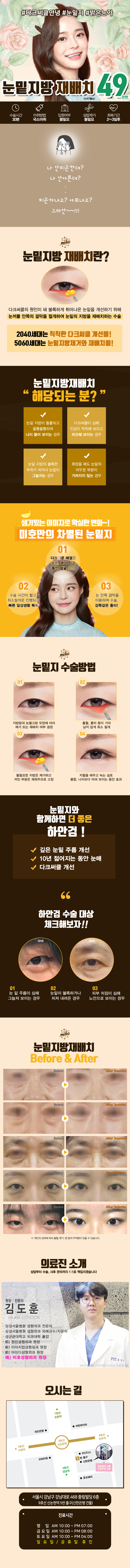 강남 미호성형외과의 눈밑지방재배치 시술로 다크서클 개선 및 자연스러운 눈밑 케어 (49만원)