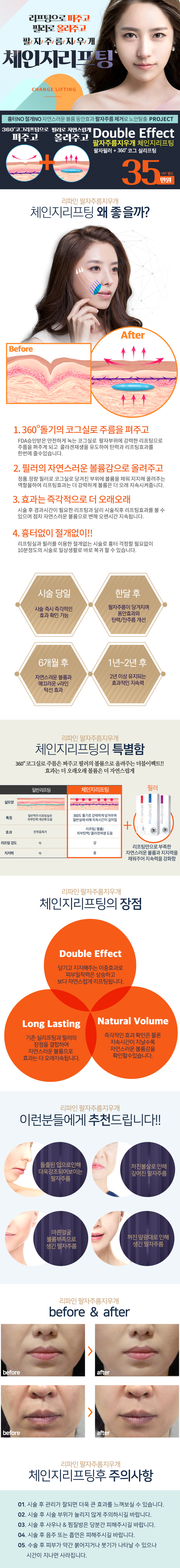 리파인피부과의 체인지리프팅은 리프팅과 필러를 결합한 이중효과로 팔자주름을 개선하는 35만원 시술