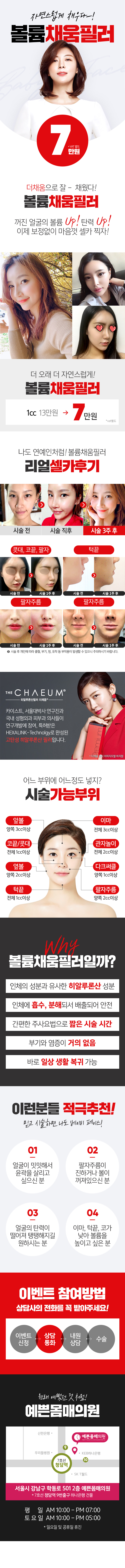 서울 교대 예쁜몸매의원의 7만원 볼륨UP 채움필러 시술 프로모션