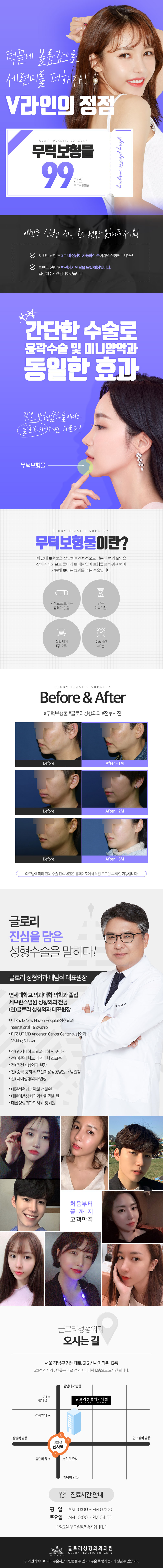 서울 신사동의 글로리성형외과에서 제공하는 99만원 특가의 V라인 무턱성형 시술 프로모션