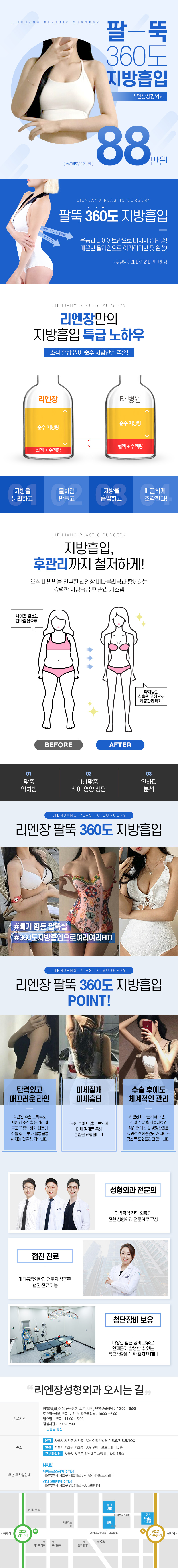 리엔장성형외과의 360도 팔지방흡입 시술로 여리여리한 팔뚝 라인 완성 (88만원)