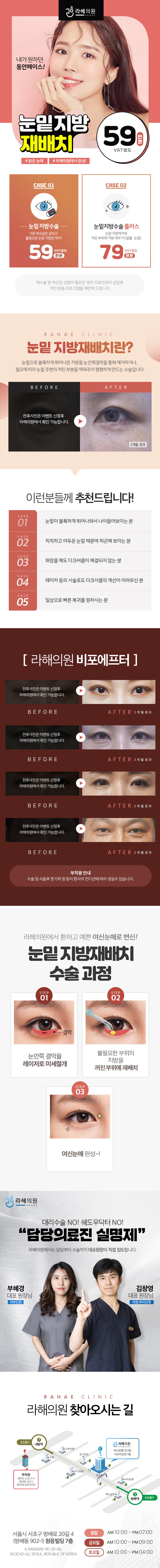 라해의원의 눈밑지방재배치 시술로 다크서클과 눈밑지방을 개선하는 59만원 특가 이벤트