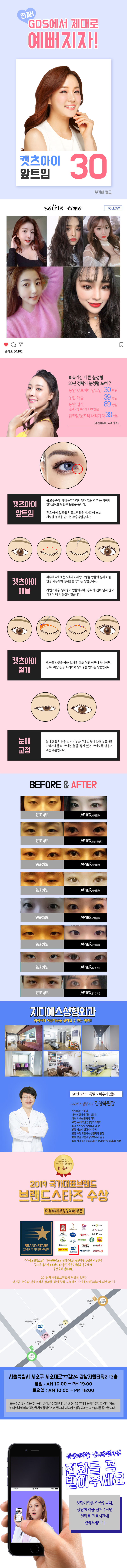 GDS성형외과의 캣츠아이 앞트임 시술로 답답한 눈매를 시원하고 매력적으로 개선하는 30만원 프로모션