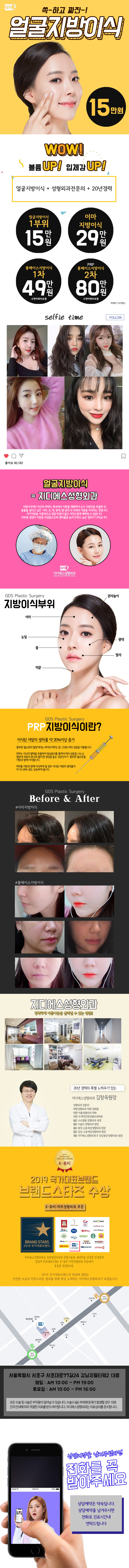 서울 강남 GDS성형외과의 15만원 동안 얼굴지방이식 프로모션 광고로, 얼굴 볼륨 개선을 위한 특별 이벤트