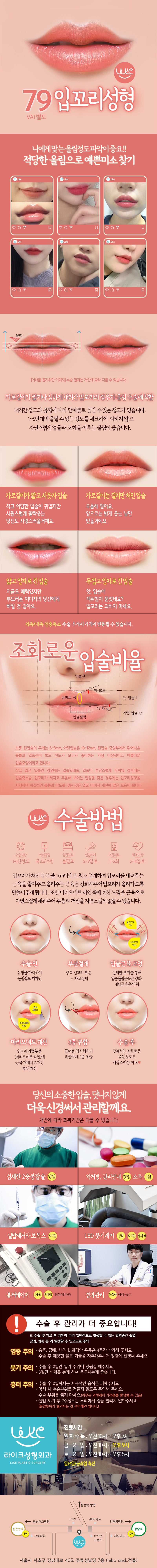 라이크성형외과의 79만원 입꼬리 성형 시술로 자연스러운 미소라인 개선