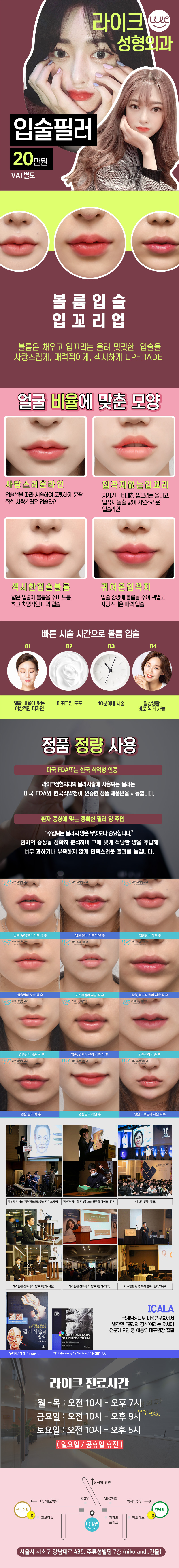 서울 강남 라이크성형외과의 20만원 입술필러 시술로 볼륨감 있고 매력적인 입술 라인 완성