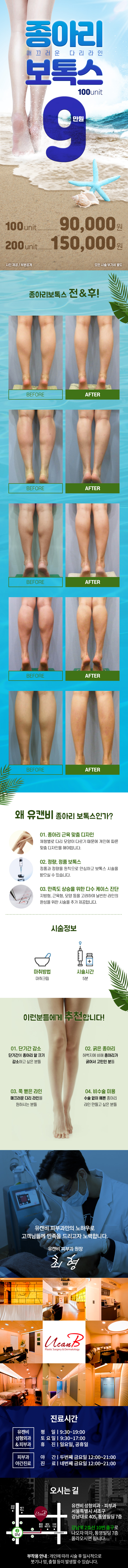 강남 유캔비성형외과의 종아리보톡스 시술 9만원 특가 프로모션 - 여름 휴가 시즌 대비 종아리 라인 개선