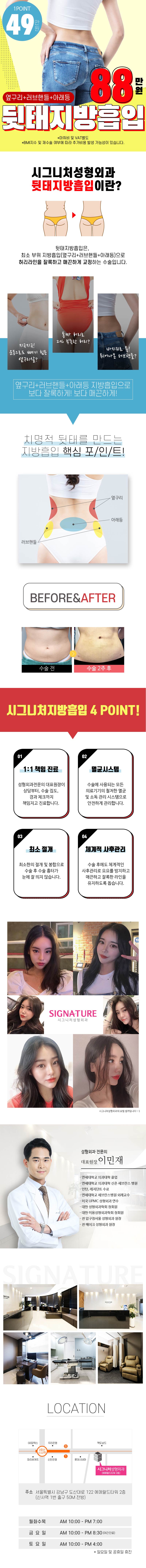서울 신사동 시그니처성형외과의 매끈한 뒷태라인을 위한 대용량 지방흡입 시술 (49만원 특가)