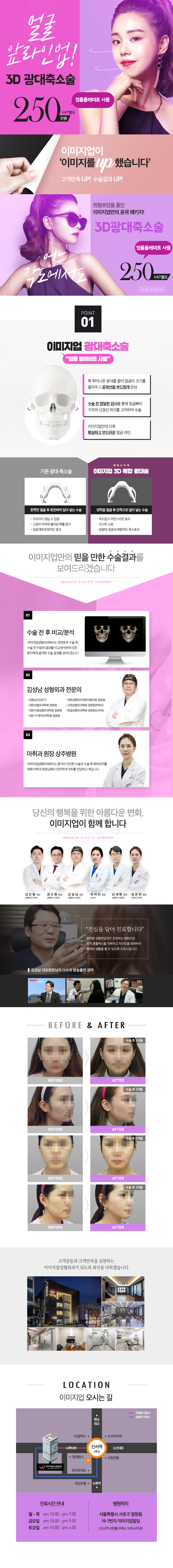 서울 신사동 소재 인터내셔널이미지업 성형외과의 3D 광대축소술 250만원 특별 프로모션
