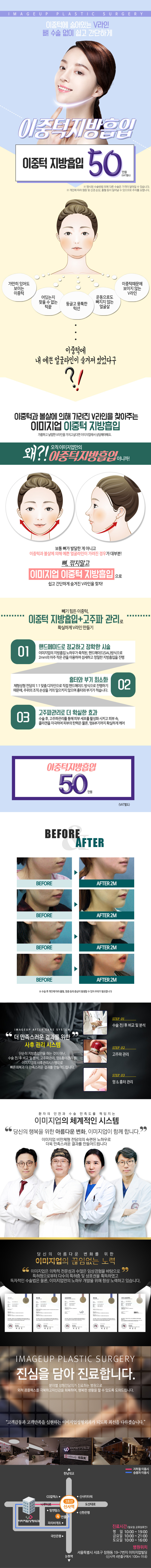 뼈수술 없이 V라인을 만들 수 있는 이중턱 지방흡입 시술 50만원 특가 프로모션