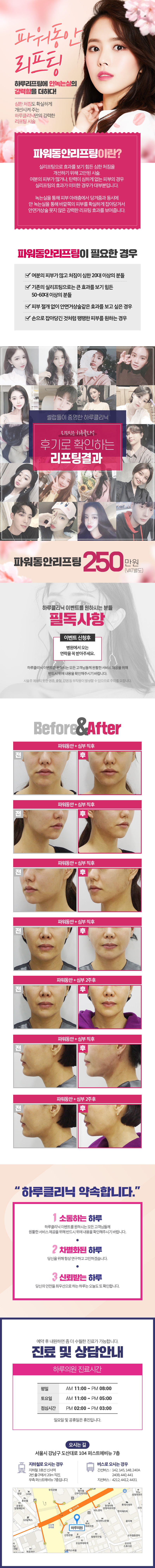 서울 신사동 하루클리닉의 파워동안리프팅 시술로 250만원에 안면거상술 수준의 리프팅 효과를 제공