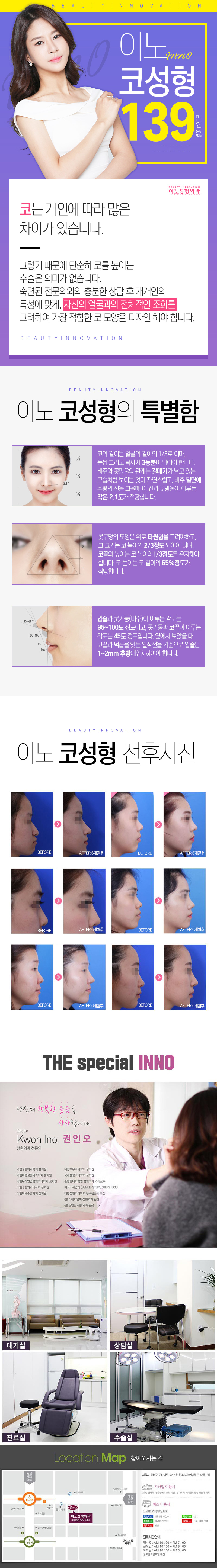 서울 신사동 이노성형외과의 139만원 맞춤형 코성형 시술로 자연스럽고 입체적인 코라인 완성
