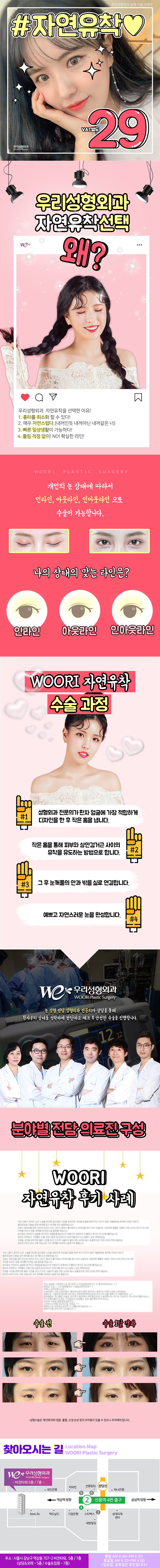 서울 교대 우리성형외과의 첫 눈성형 특가 이벤트, 자연유착 시술 29만원