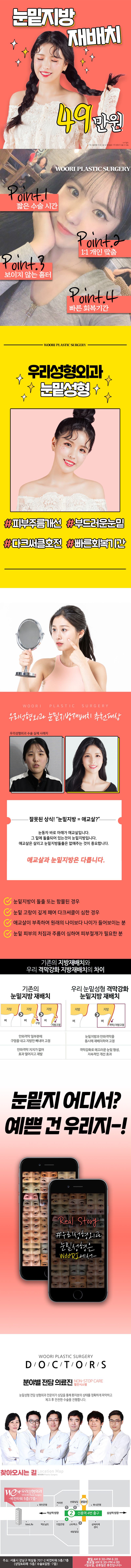 서울 교대 우리성형외과의 49만원 격막강화 눈밑지방재배치 시술 프로모션