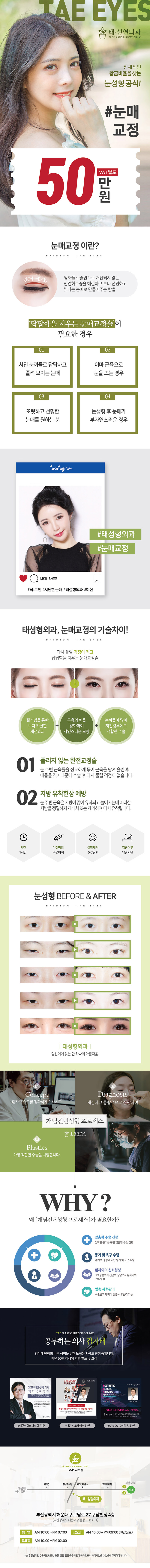 울산 중구 태성형외과의 황금비율 눈매교정 시술, 50만원 특가 프로모션