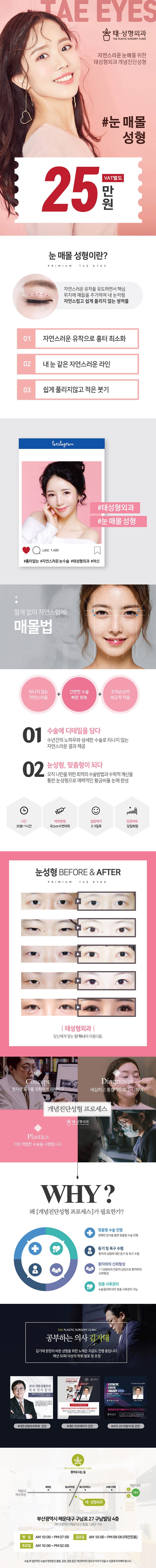울산 중구 태성형외과의 여름 한정 자연스러운 눈매몰 성형 이벤트 25만원 특가 프로모션