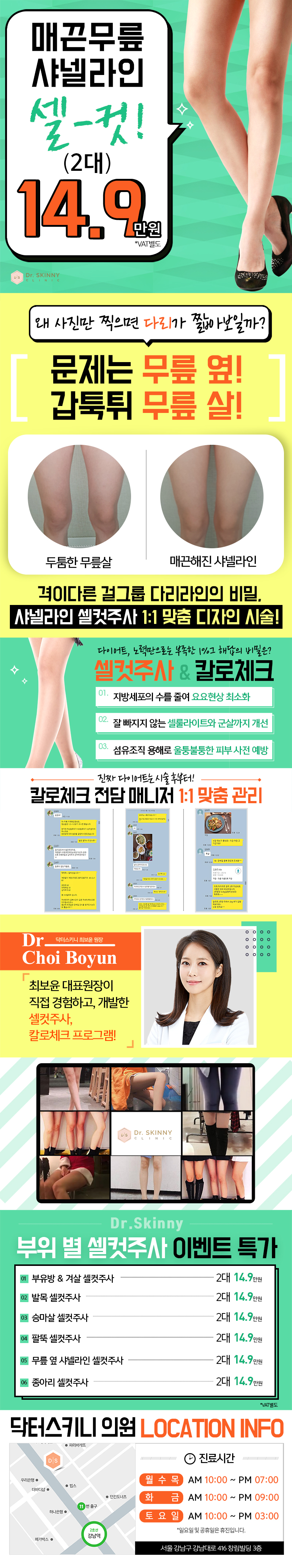 강남 닥터스키니의원의 무릎 샤넬라인 셀컷주사 시술로 매끈한 다리라인 개선 (2대 14.9만원)