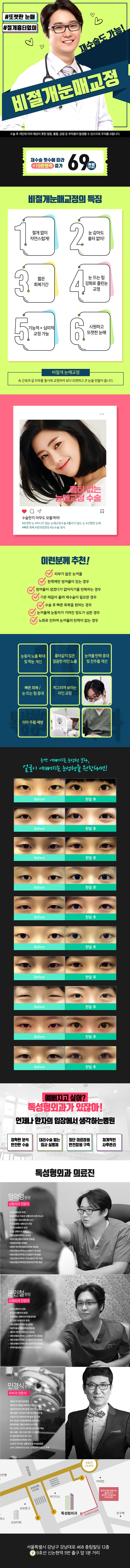 강남 톡성형외과의 69만원 비절개눈매교정 시술로 빠른회복과 자연스러운 쌍꺼풀 형성