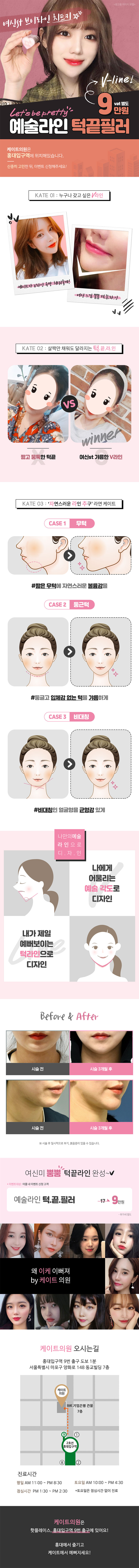 서울 교대 케이트의원의 9만원 예술라인 턱끝필러로 자연스러운 브이라인 얼굴 완성
