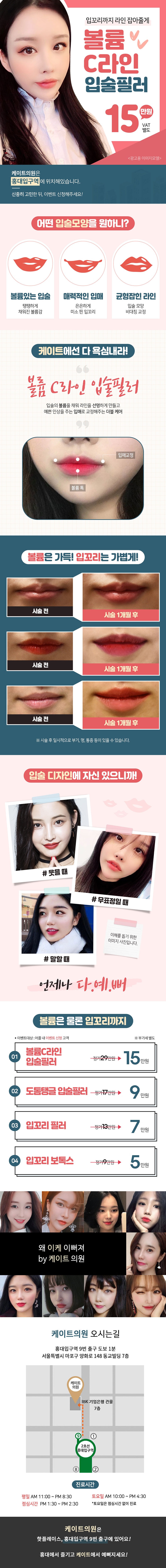 서울 교대 케이트의원의 입술 볼륨감과 입꼬리 디자인을 동시에 개선하는 볼륨C라인 입술필러 시술 (15만원)