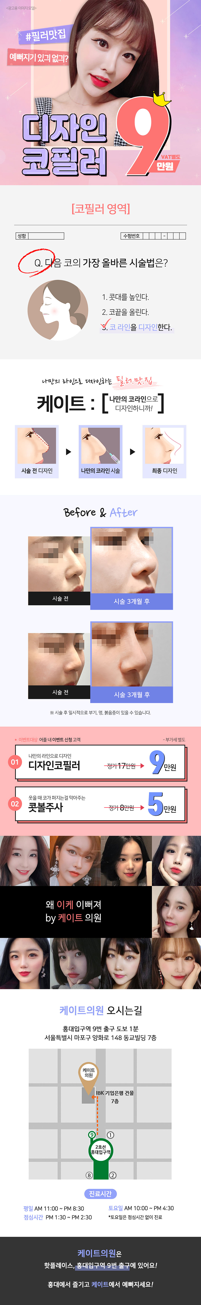 서울 교대 케이트의원의 9만원 디자인 코필러 시술 홍보 - 자연스러운 코 라인 개선 시술
