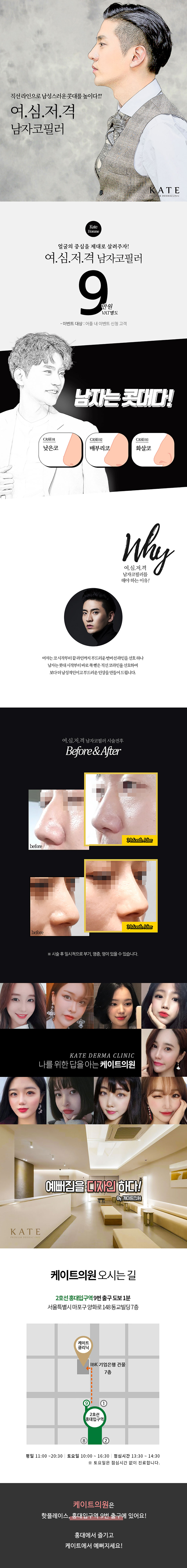 서울 교대 케이트의원의 9만원 남자 코필러 시술 - 수술 없이 여성들이 선호하는 남성적인 코라인 디자인