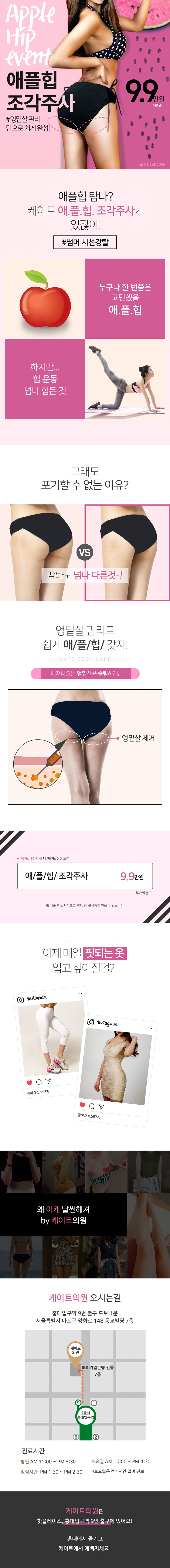 케이트의원의 애플힙 조각주사 시술로 엉밑살 관리를 통해 9.9만원에 이상적인 힙 라인 완성
