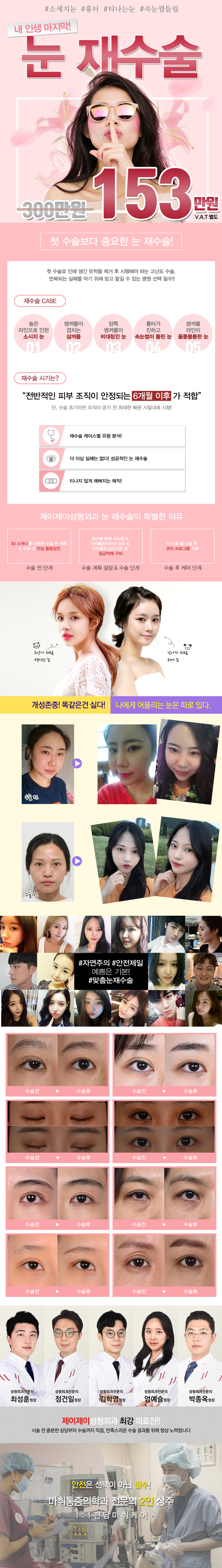 압구정 제이제이성형외과의 눈 재수술 프로모션 - 300만원에서 153만원으로 할인된 맞춤형 눈 재수술 프로그램