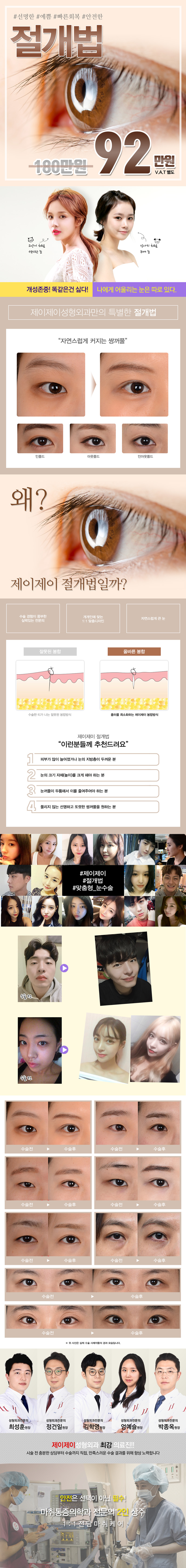 제이제이성형외과의 선명하고 예쁜 절개법 쌍꺼풀 수술 92만원 프로모션