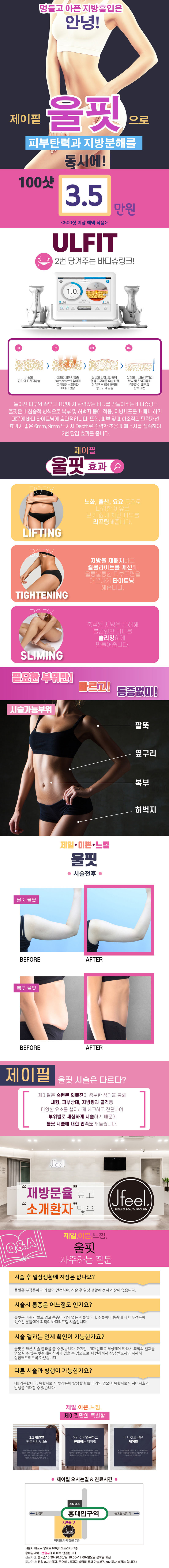 제이필의원의 바디슈링크 울핏 시술로 배, 엉밑살, 허벅지, 팔뚝 등 원하는 부위를 3.5만원에 탄탄하고 매끈하게 관리