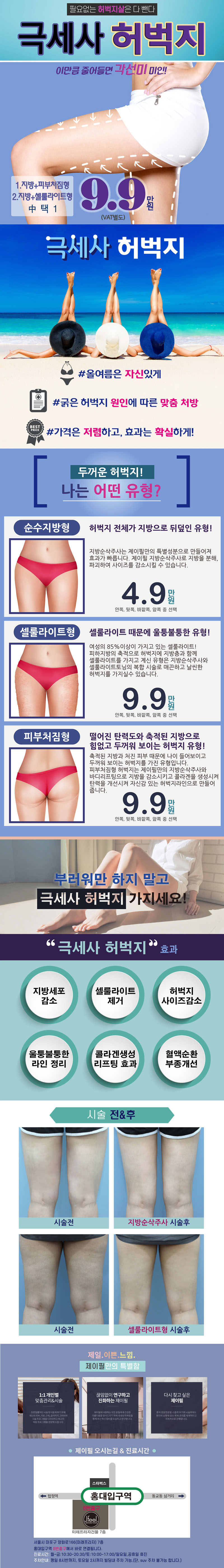서울 교대 제이필의원의 극세사허벅지 시술로 두껍고 처진 허벅지, 셀룰라이트 고민 해결 (9.9만원)