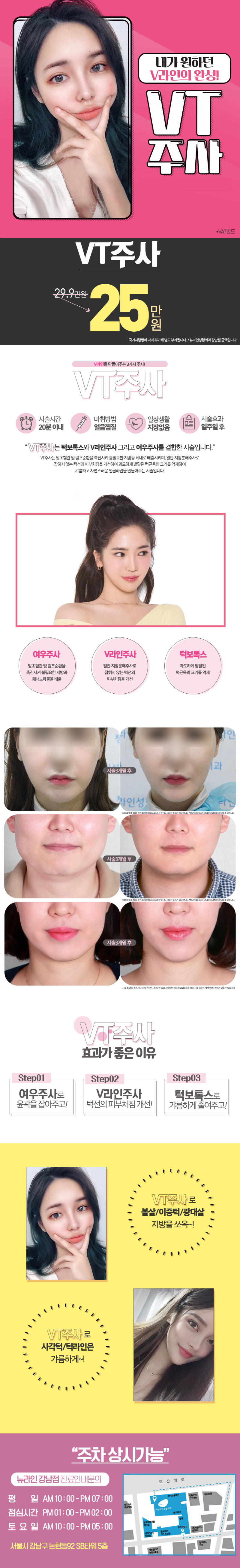 강남 뉴라인성형외과의 V라인 얼굴 윤곽을 위한 3단계 VT주사 시술 (25만원)