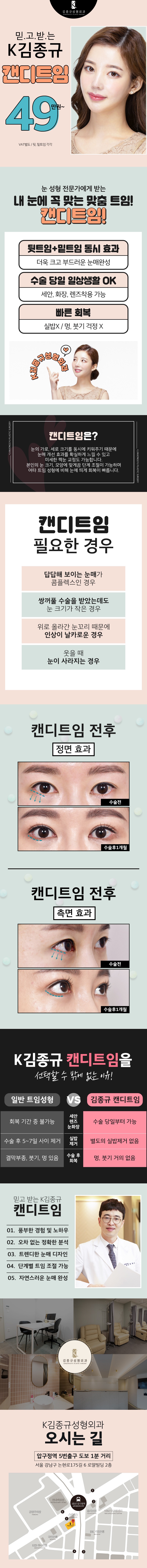 서울 신사동 K김종규성형외과의 49만원 캔디트임 수술: 뒷트임과 밑트임을 통한 자연스러운 눈매 교정