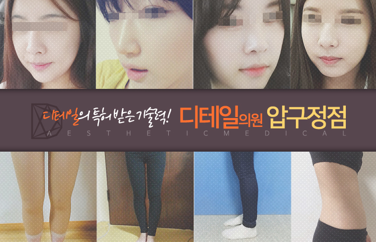 디테일의원 대표 이미지