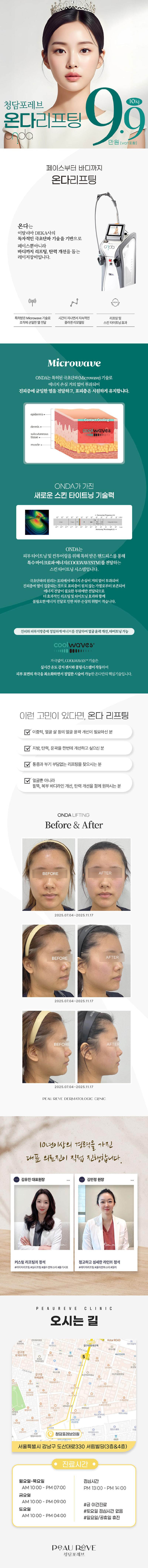 청담포레브의원의 청담포레브 온다리프팅 10KJ 이벤트 시술