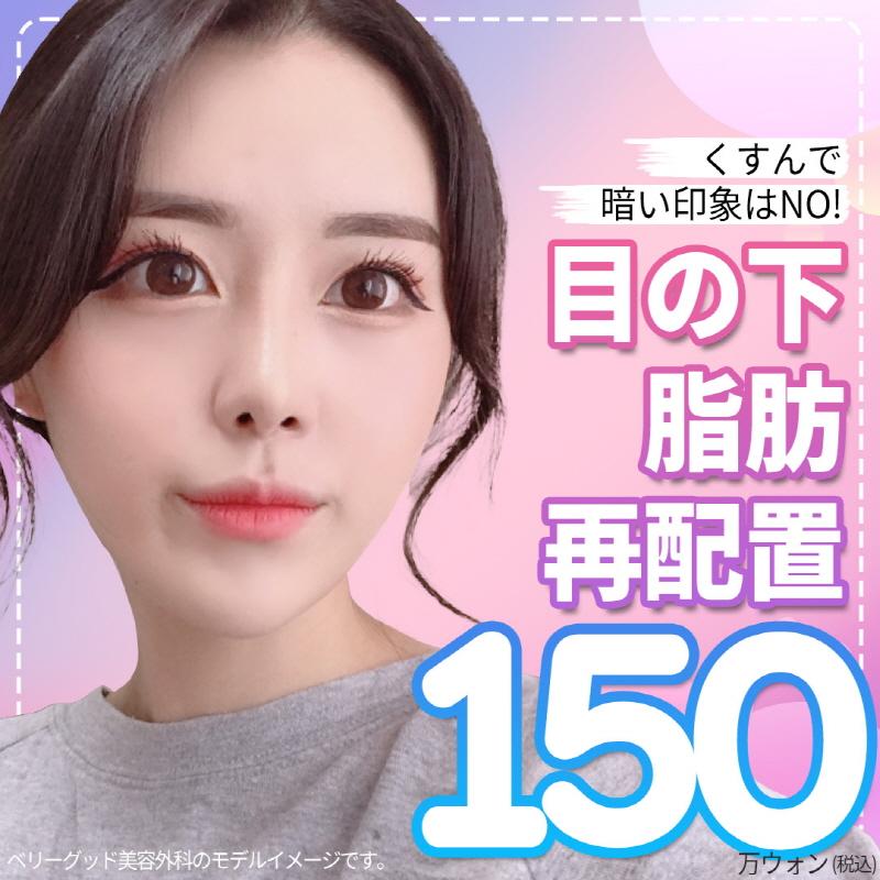 VG　目の下脂肪再配置