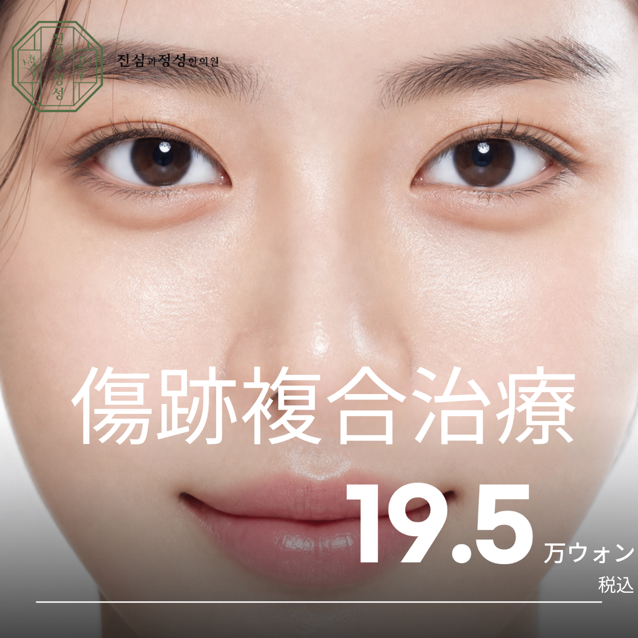 傷跡 複合治療