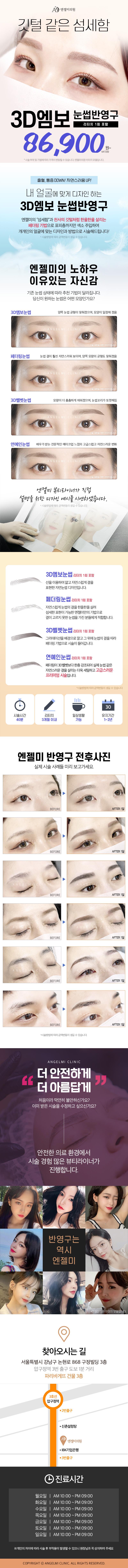 압구정 엔젤미의원의 3D멀티 눈썹반영구 시술 서비스 (86,900원)